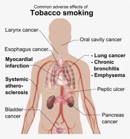 Adverse Effects Of Tobacco Smoking - Disease From Cigarette Smoking, HD Png Download, Transparent PNG