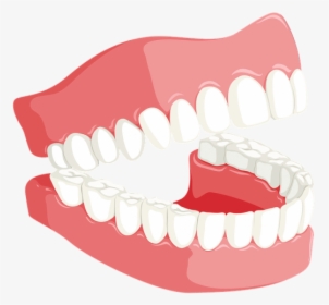 Transparent Tooth Clipart Png - Teeth Dental Png, Png Download, Transparent PNG