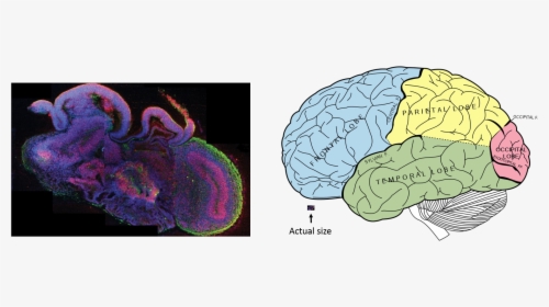 Transparent Human Brain Clipart - Mini Brains, HD Png Download, Transparent PNG