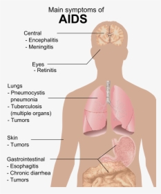 Symptoms Of Aids - Aids Symptoms Png, Transparent Png, Transparent PNG