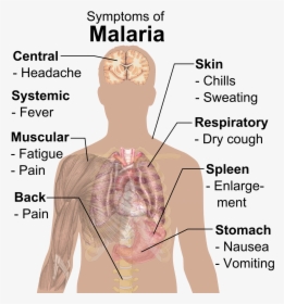 Symptoms Of Malaria - Symptom Of Malaria, HD Png Download, Transparent PNG