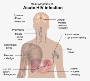 Symptoms Of Acute Hiv Infection - Hiv Symptoms, HD Png Download, Transparent PNG