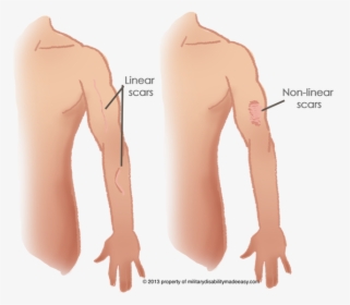 Linear Scars, HD Png Download, Transparent PNG