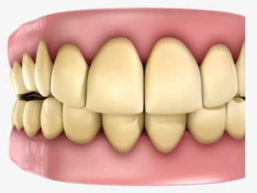 Yellow Teeth - Fact And Myth About Health, HD Png Download, Transparent PNG