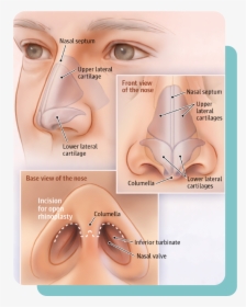 Lower Lateral Cartilage Nose Job, HD Png Download, Transparent PNG