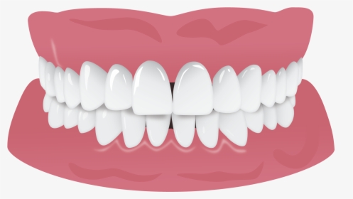 Invisalign Gap Teeth Missing Tooth, HD Png Download, Transparent PNG