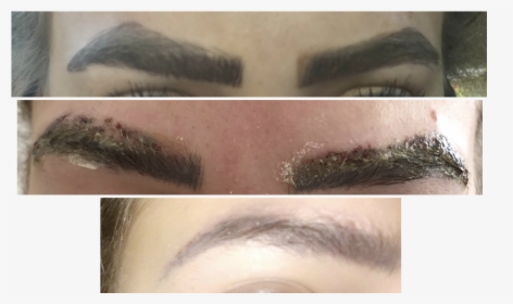 Elinimink Eyebrow Correction - Laser Tattoo Removal Microblading, HD Png Download, Transparent PNG