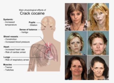 Picture - Effects Of Crack Cocaine, HD Png Download, Transparent PNG