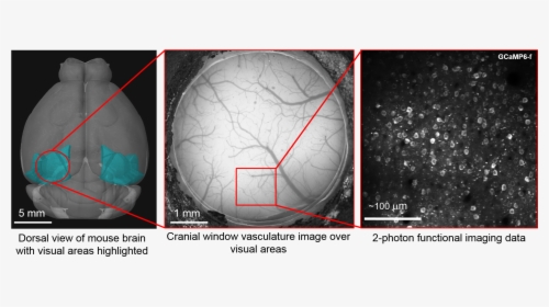 Png File Surgery - Visual Cortex Mouse Brain Cranial, Transparent Png, Transparent PNG