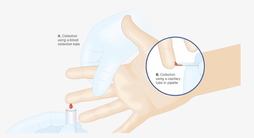 Collecting A Finger Capillary Blood Sample Via Blood - Blood Collection Procedures Adult Hand, HD Png Download, Transparent PNG