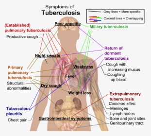 Tuberculosis Symptoms - Symptoms Of Tuberculosis, HD Png Download, Transparent PNG