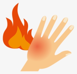 Skin Clipart Burned Food - Burned Hand Clipart, HD Png Download, Transparent PNG