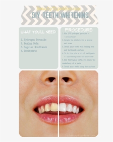 Ways To Make Ur Teeth Straight, HD Png Download, Transparent PNG