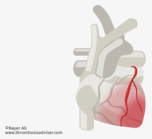Cardiac Muscle Damage In Acs - Illustration, HD Png Download, Transparent PNG