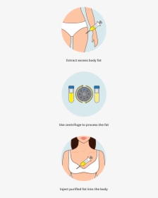 Breast Augmentation Fat Transfer - Circle, HD Png Download, Transparent PNG