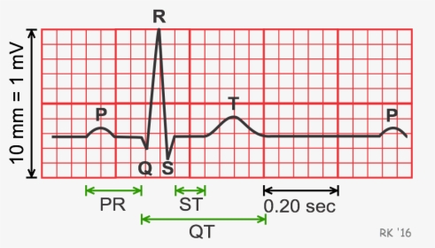 Electrocardiogram Durations And Intervals - Ecg Duration, HD Png Download, Transparent PNG