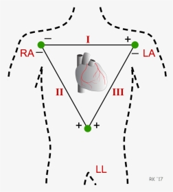 Ecg Einthoven Triangle - Limb Leads, HD Png Download, Transparent PNG