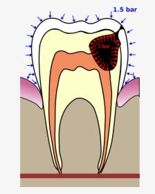 Tooth Squeeze While Diving, HD Png Download, Transparent PNG