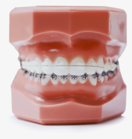 Straight Teeth Model, HD Png Download, Transparent PNG