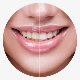Charcoal Blast Teeth Whitening Powder Reviews, HD Png Download, Transparent PNG
