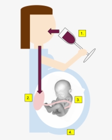 Fetal Alcohol Syndrome Gif, HD Png Download, Transparent PNG