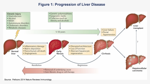Kavitha1 - Pathophysiology Of Chronic Liver Cell Disease, HD Png Download, Transparent PNG