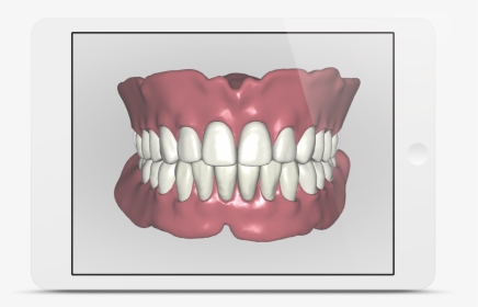 Avadent Ipad - 3d Gebitsprothese, HD Png Download, Transparent PNG