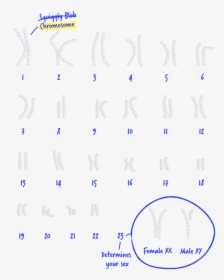 Chromosomes Of Hurler Syndrome, HD Png Download, Transparent PNG