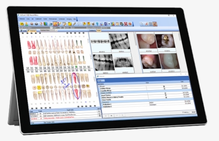 Tablet Mockup 12 19 16 - Medical Practice Management Software, HD Png Download, Transparent PNG
