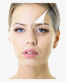 Beautiful Woman With Half Face Spotty Skin , Png Download, Transparent Png, Transparent PNG