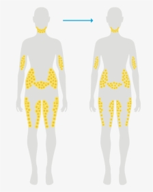 Body Fat Dissolving Injections, HD Png Download, Transparent PNG