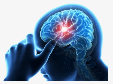 Risk Carotid Stroke Chiropractic Care - Brain Stroke Png Clipart, Transparent Png, Transparent PNG