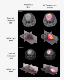 Molecular Fluorescence Data Is Shown As A 3d Maximum - Sphere, HD Png Download, Transparent PNG