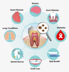Improve Your Today With Lab A Recent - Dental Disease Clip Art, HD Png Download, Transparent PNG
