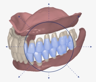 Signatureteeth - Signature Digital Dentures, HD Png Download, Transparent PNG