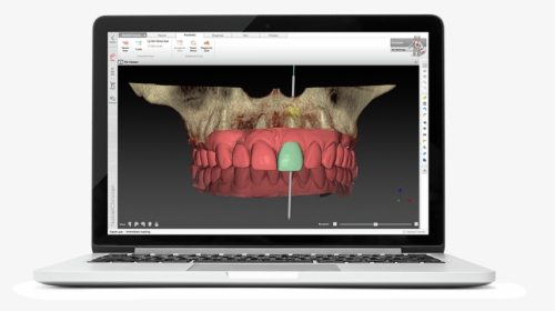 Digital Dentistry Workflow Courses - Netbook, HD Png Download, Transparent PNG