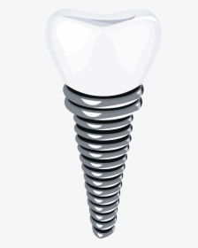 Dental Implant Png Clip Art - Transparent Implant, Png Download, Transparent PNG