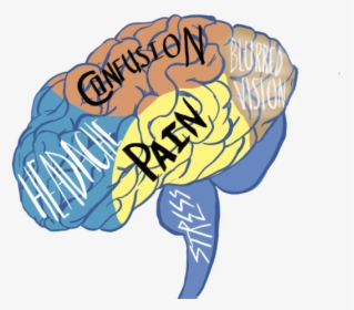 Issues Concussions The Kirkwood - Concussion Art, HD Png Download, Transparent PNG