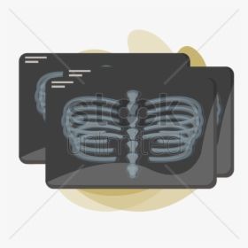 X-ray Of Human Rib Cage V矢量图形 - Illustration, HD Png Download, Transparent PNG
