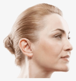 Non-surgical Facelift - Double Chin, HD Png Download, Transparent PNG