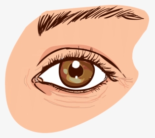 Eye-wrinkles - Causes Dark Circles Eye, HD Png Download, Transparent PNG