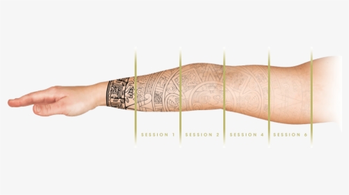 Tri Beam Tattoo Removal Results, HD Png Download, Transparent PNG