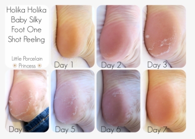 My Feet Did Peel Lightly For A Couple Of Days After - Skin Republic Foot Peel Review, HD Png Download, Transparent PNG