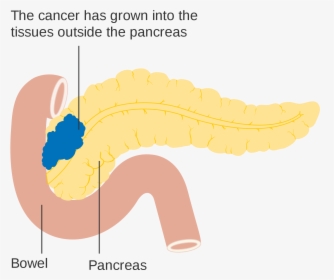 Pancreas Diagram Png , Png Download - Illustration, Transparent Png, Transparent PNG