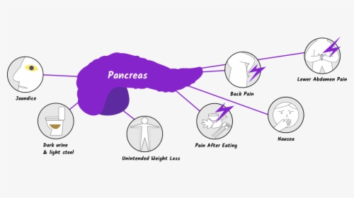 Pancreatic Cancer Symptoms, HD Png Download, Transparent PNG