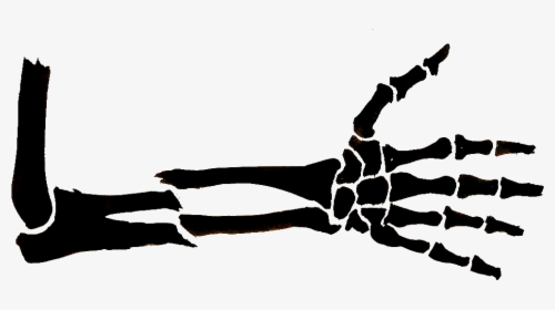 Broken Arm Drawing Clipart , Png Download - Broken Arm Bone Drawing, Transparent Png, Transparent PNG