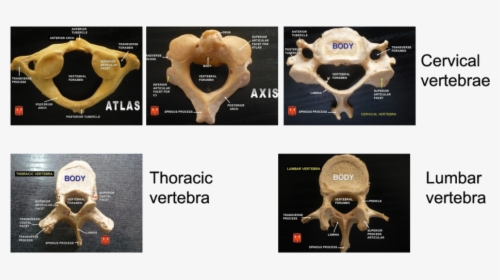 Types Of Vertebrae Anatomy, HD Png Download, Transparent PNG