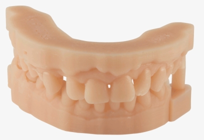 Dental D Material Prodways - 3d Printed Dental Model, HD Png Download, Transparent PNG