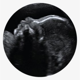 Prenatal Ultrasound Clipart, HD Png Download, Transparent PNG