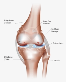 Knee Arthritis - Simple Knee Joints Diagram, HD Png Download, Transparent PNG